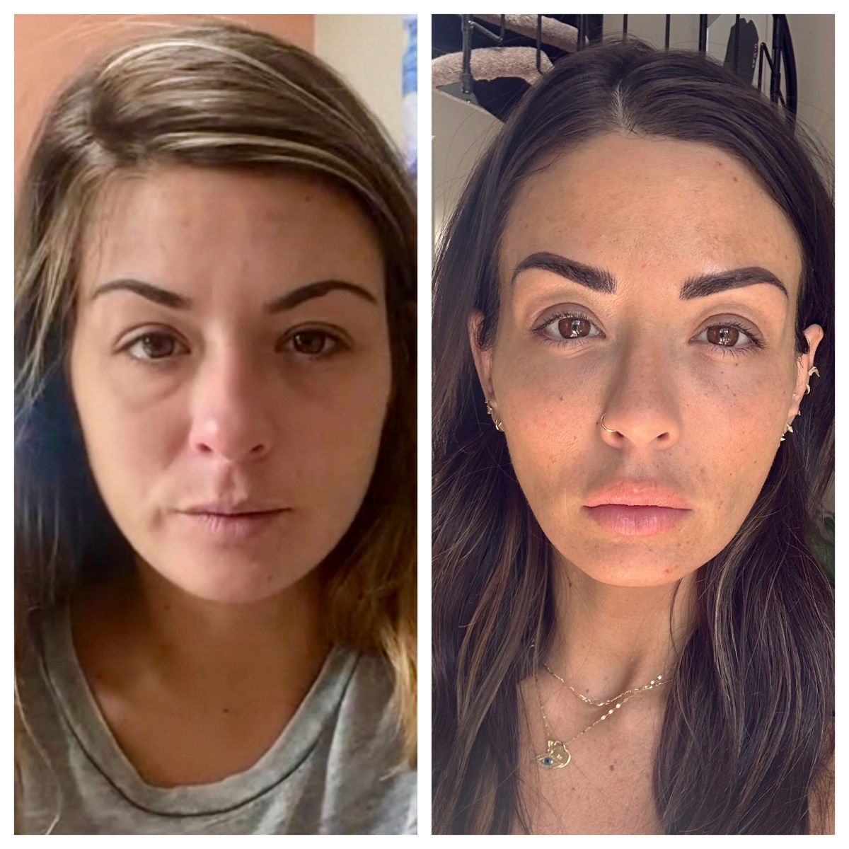 She did WHAT to her face?! Mindful Muse